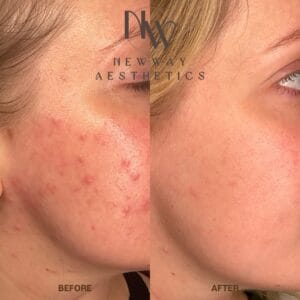 NEWWAY Aesthetics